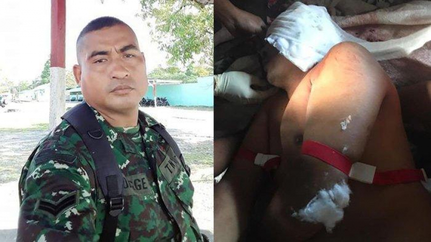 Sertu La Ongge. (Foto: medan.tribunnews.com)