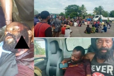 Korban Tembakan Hendrik Lokbere. (foto-istimewa)