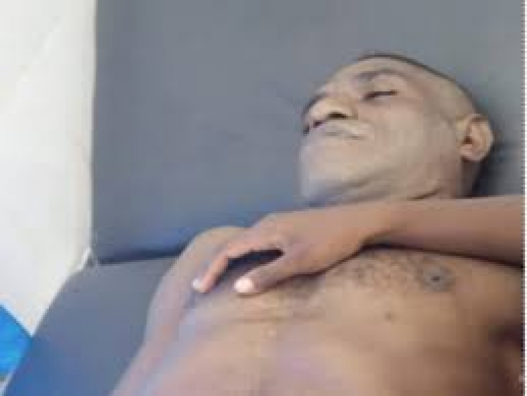 Marius Betera (MB), korban kekerasan fisik yang dilakukan oleh oknum kepolisian di PT. TSE POP A/ Camp 19, Distrik Jair, Kabupaten Boven Digoel