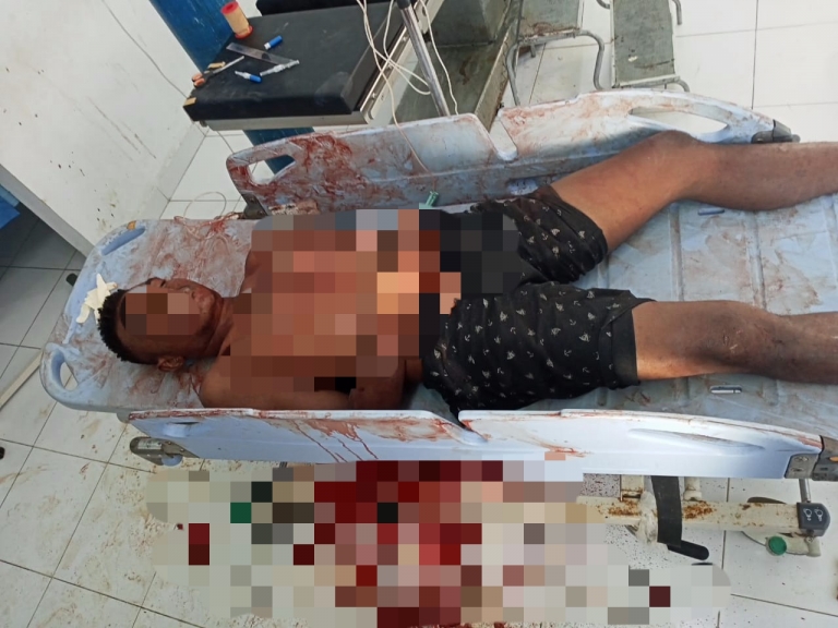 Pelaku Pencurian yang ditikam pemilik rumah di Wosi, kabupaten Manokwari, Minggu (19/7)