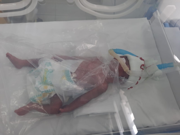 Bayi yang ditemukan digunung meja telah diselamatkan dan diletakkan di inkubator