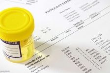 DPD GPM Malut Tantang Bupati Halsel Lakukan Test Urine Narkoba Kepada Seluruh OPD. [Foto: mercola.com]