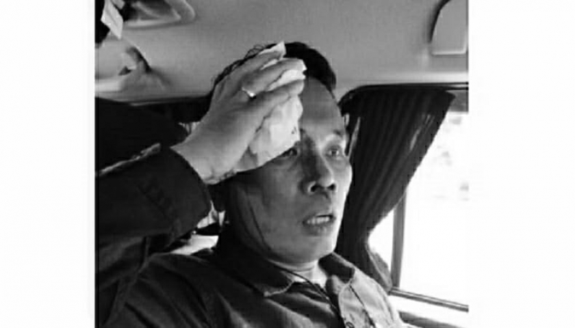 Kasat Intel Polres Metro Jakarta Pusat AKBP Ferikson Tampubolon terluka robek di kepala akibat terkena pukulan oleh salah seorang pendemo. [Foto: ist]